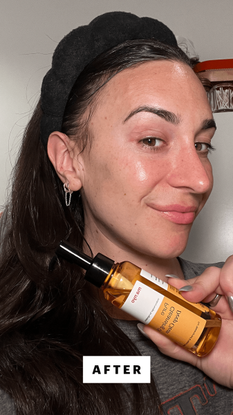 Wohlner after applying the Manyo Pure Cleansing Oil